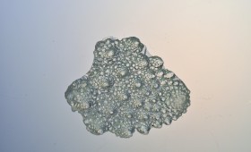 Broccoli Coral 2011